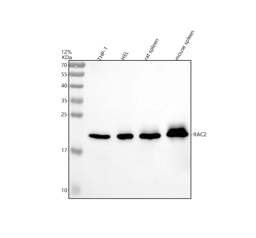 Askey Rac2 博士德生物 BOSTER Biological Technology co.ltd | 1993-2025