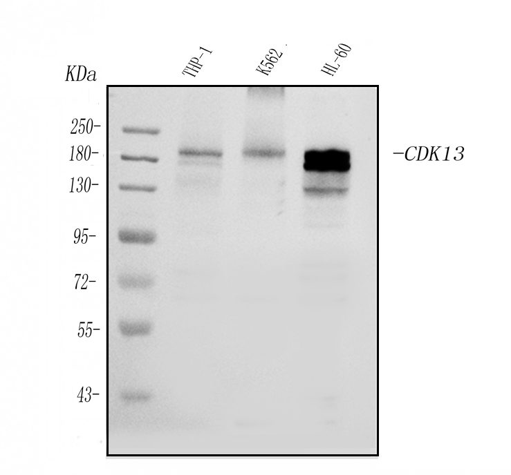 Cdk13 Ribbon 博士德生物 BOSTER Biological Technology co.ltd | 1993-2026