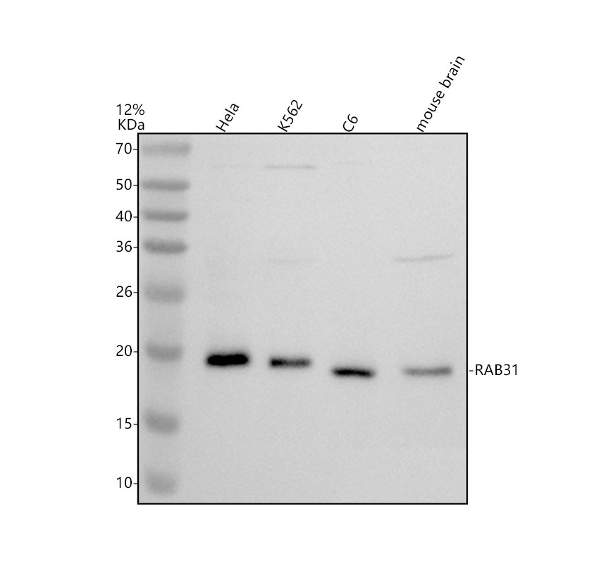 博士德生物 BOSTER Biological Technology co.ltd | 1993-2026