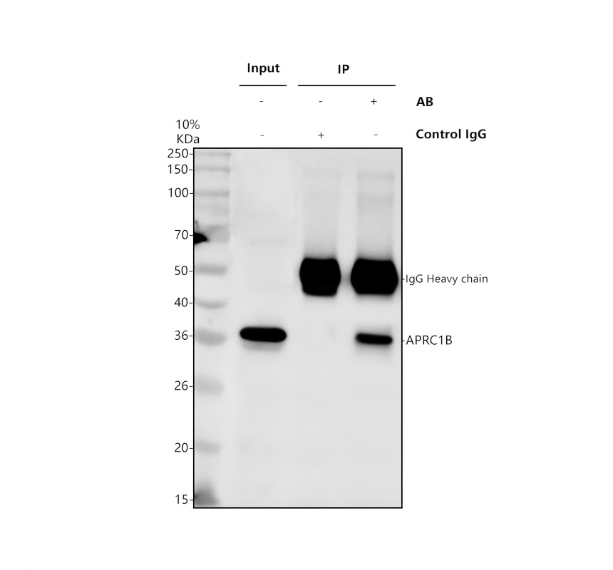 Ip Analysis 博士德生物 BOSTER Biological Technology co.ltd | 1993-2026