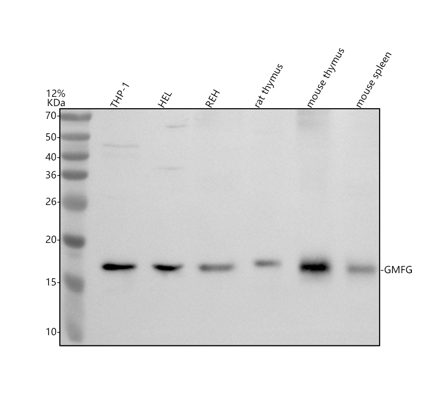 Gmfg Script 博士德生物 BOSTER Biological Technology co.ltd | 1993-2025