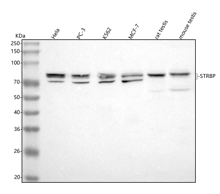 Strb Recommendation 博士德生物 BOSTER Biological Technology co.ltd | 1993-2025