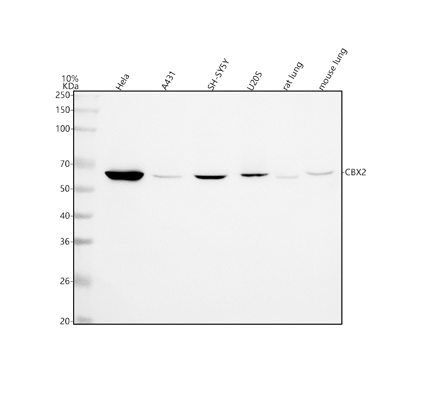22c76 博士德生物 BOSTER Biological Technology co.ltd | 1993-2025
